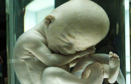 feto humano